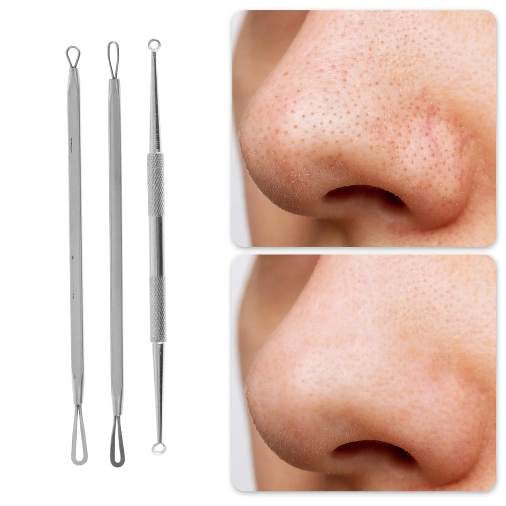 Professional Pimple Extractor Tool Kit Acne Removal Comedone Blackhead Remover Skin Care Beauty Face Tools Silver Tone