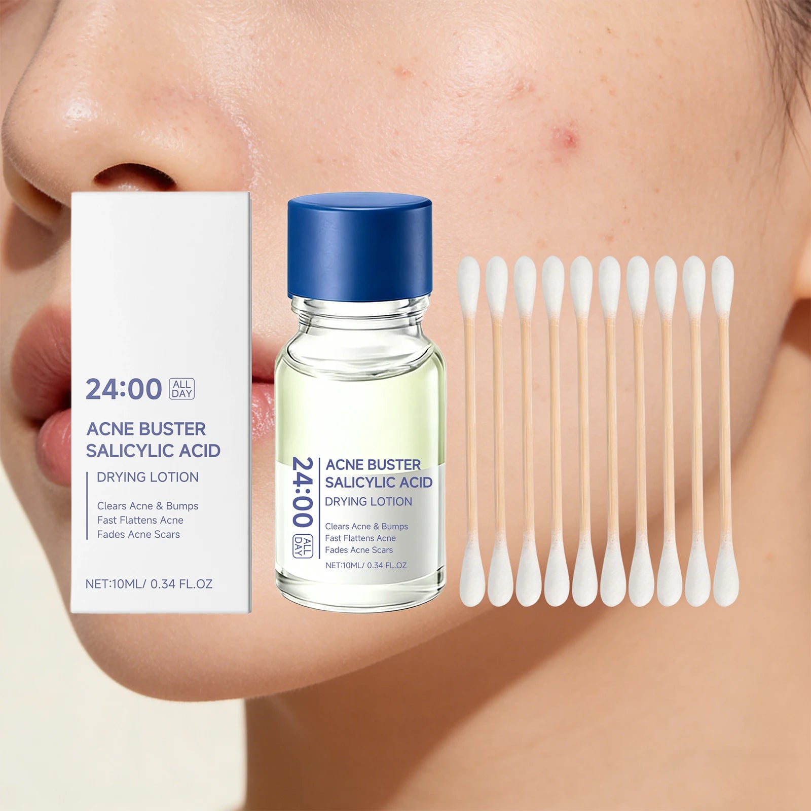 Salicylic Acid Drying Lotion Face Serum with Cotton Swab– Reduce Pimples & Breakouts Fade Acne Scars Minimize Pores Skin Renewal